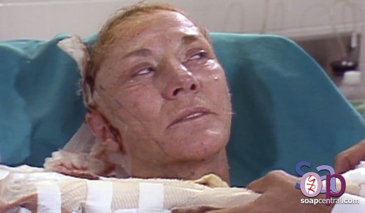 Katherine's bandages are removed and she sees her post-facelift face (1984)